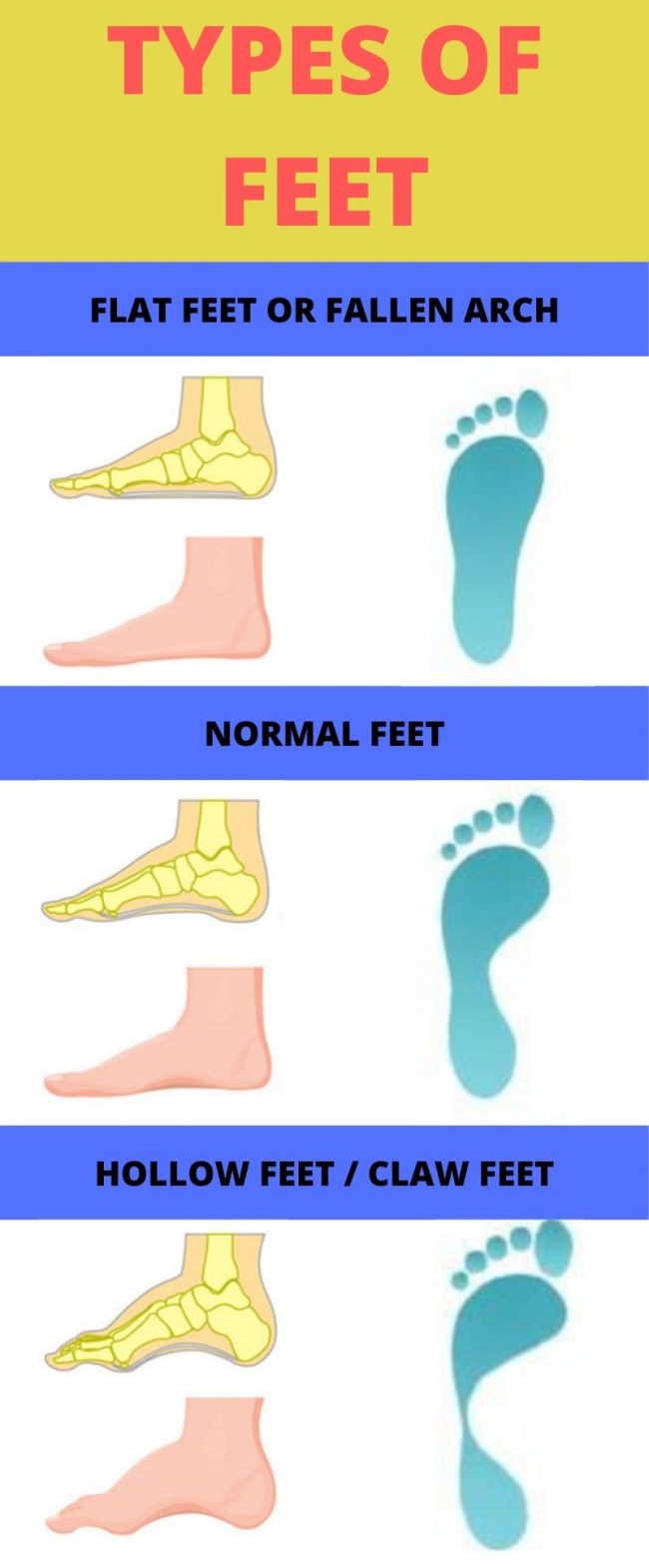 Types of Feet